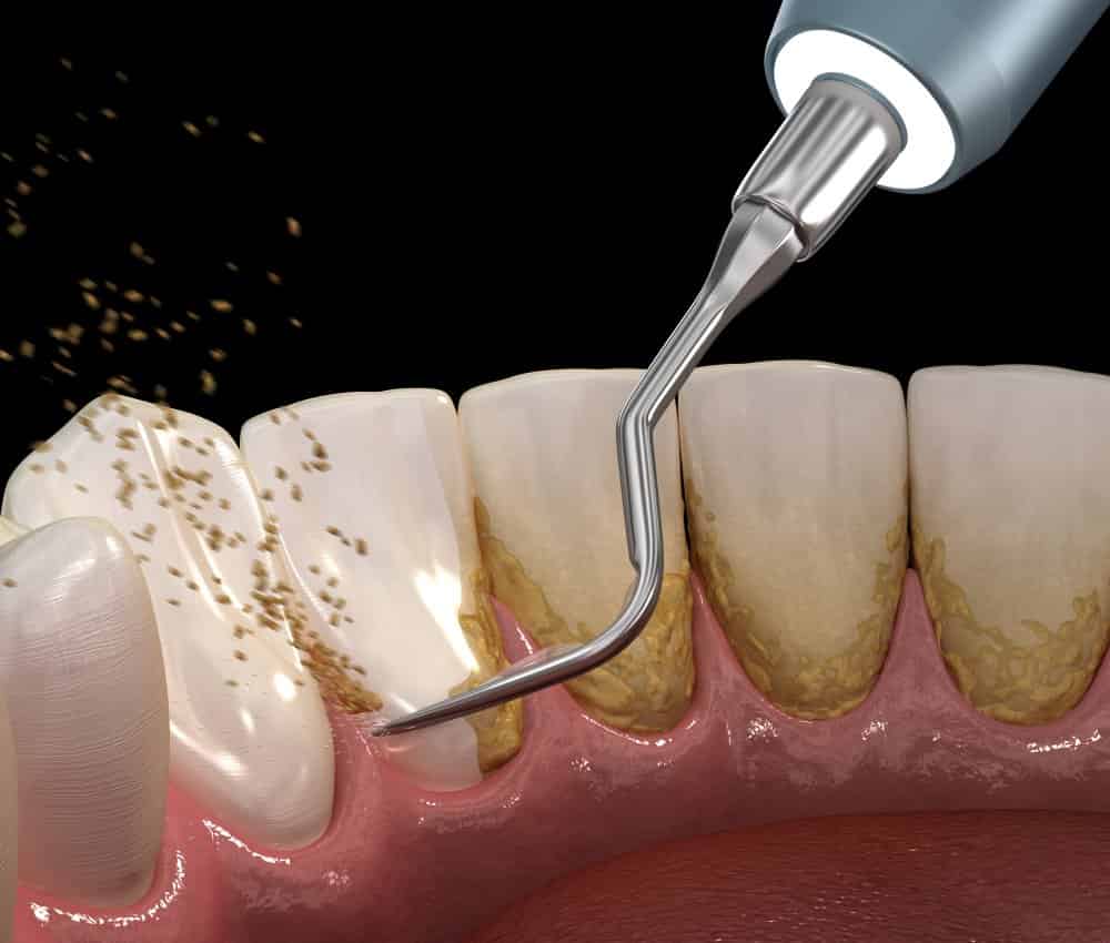 Процесс чистки зубов